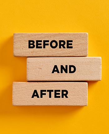 Before and After at Shine Cosmetic Surgery in West Covina, CA