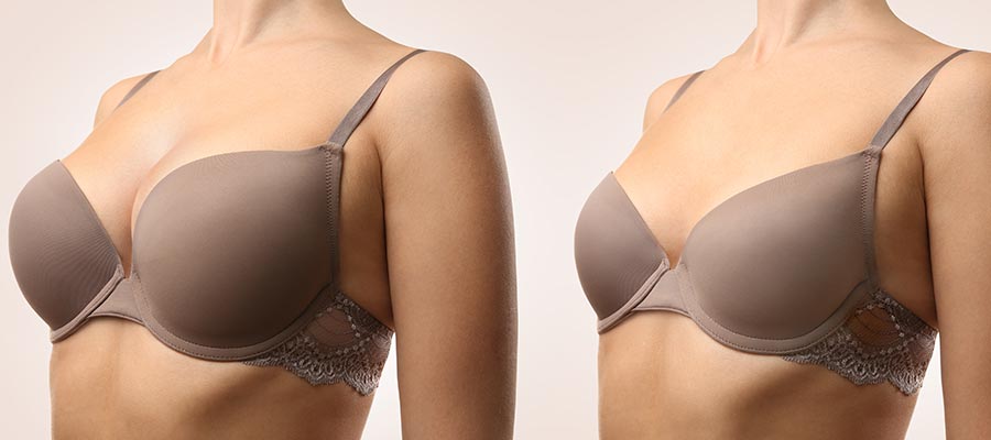 Breast Implant Removal Specialist Near Me in West Covina, CA