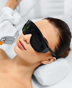 IPL Photofacial in West Covina, CA