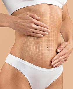 Tummy Tuck in West Covina, CA