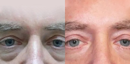 Patient #:  2085
