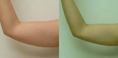 Patient #: 1940 Patient #: 1940