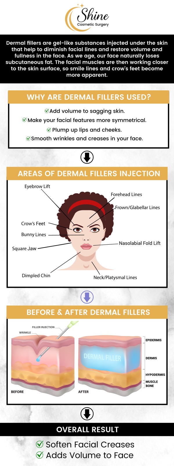 Our board-certified facial plastic surgeon, Dr. Daniel Lin, D.O. at Shine Cosmetic Surgery offers you dermal fillers in West Covina, CA, that provide the advantage of adding volume, smoothing out fine lines and wrinkles, and renewing your aging skin. For more information, contact us or schedule an appointment online. We are conveniently located at 2707 Valley Blvd, West Covina, CA 91792.