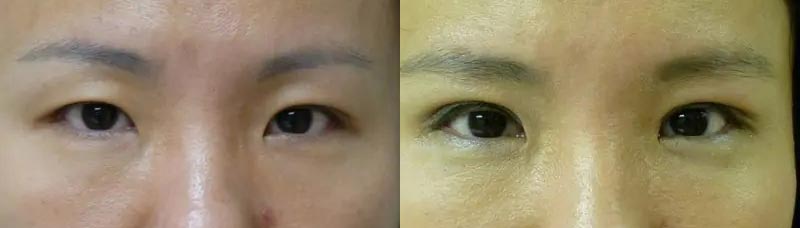 Patient #: 2062 Patient #: 2062