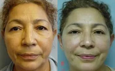 Patient #: 2041