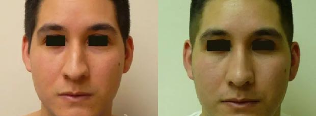Patient #: 2044 Patient #: 2044