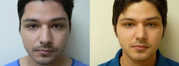 Patient #: 2049 Patient #: 2049