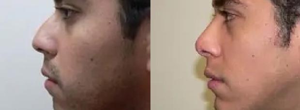 Patient #: 2054 Patient #: 2054