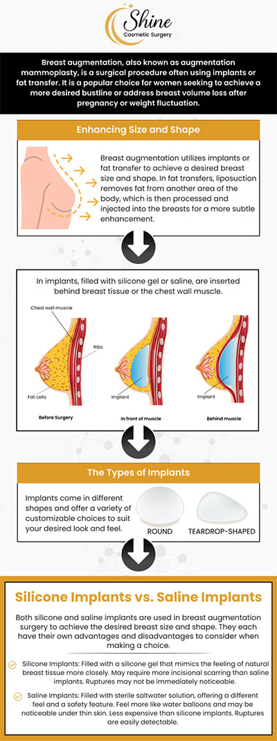The process of breast augmentation involves either fat transfer or breast implants to enlarge your breasts. In the United States, breast augmentation is among the most popular plastic surgery treatments. Enhance your natural beauty with breast augmentation from our top-rated cosmetic surgeon, Dr. Daniel Lin, D.O, at Shine Cosmetic Surgery. For more information, contact us or schedule an appointment online. We are conveniently located at 2707 Valley Blvd, West Covina, CA 91792.